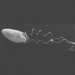 Bacteria flagellum, electron microscope photograph